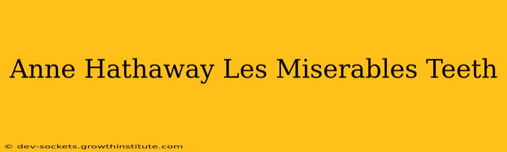 Anne Hathaway Les Miserables Teeth