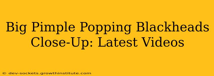 Big Pimple Popping Blackheads Close-Up: Latest Videos