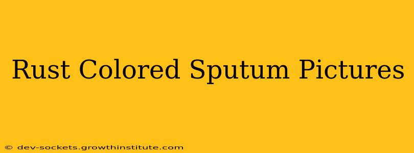 Rust Colored Sputum Pictures